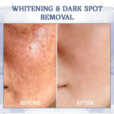 Fubsta™️ Advance Skin Tightining Cream (BUY 1 GET 1 FREE!!!)🔥