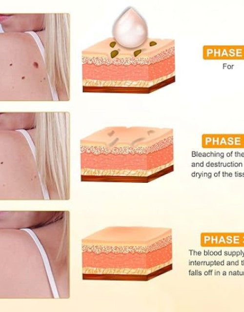 Bee Venom Cream for Removing and Repair, Professional Bee Venom Repair Cream Pack of 2