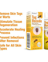 Bee Venom Wart Remover Spray 30ml (Pack of 1)